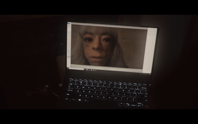 The OA P2Ep7 Dr Rhodes Video