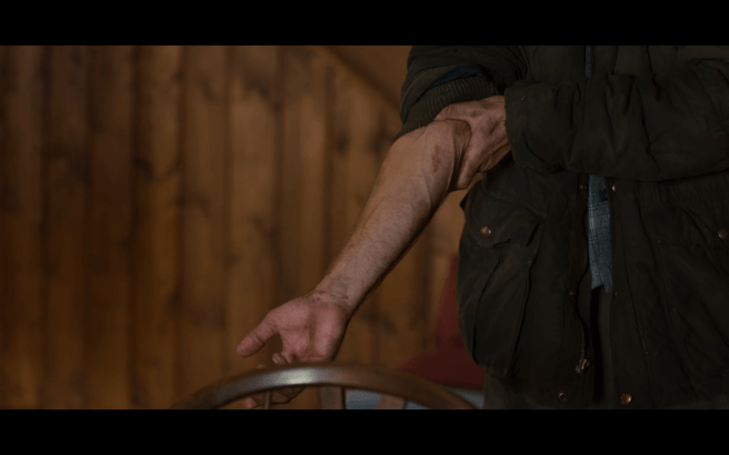 Dark S2Ep1 Jonas Bike Scar