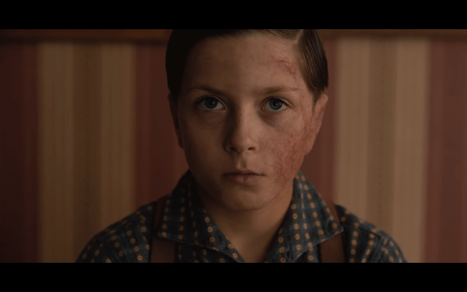 Dark S2Ep3 Helge Right After the Chair- Dull Eyes, Jaundiced Skin, Cracked Lips, More Facial Scarring