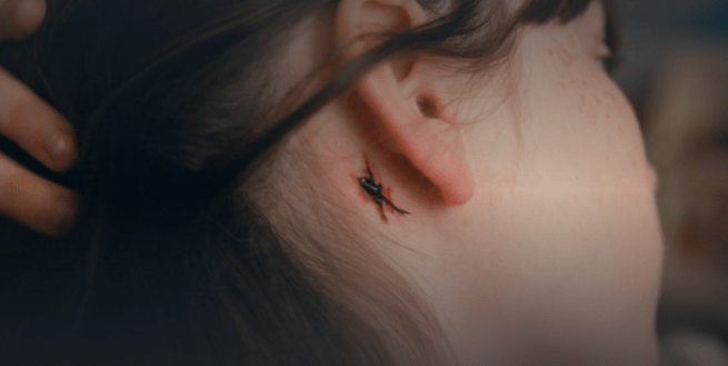 Emergence S1Ep2 Tracker Incision.png