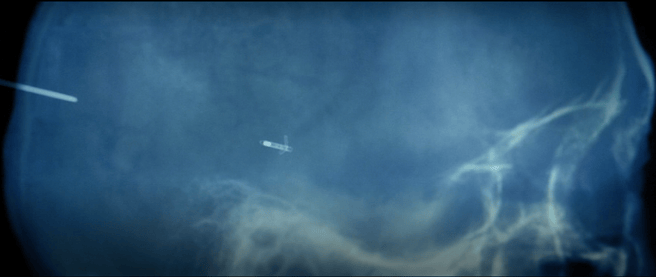 Severance Season 1 Episode 2: Half Loop Recap – Metawitches